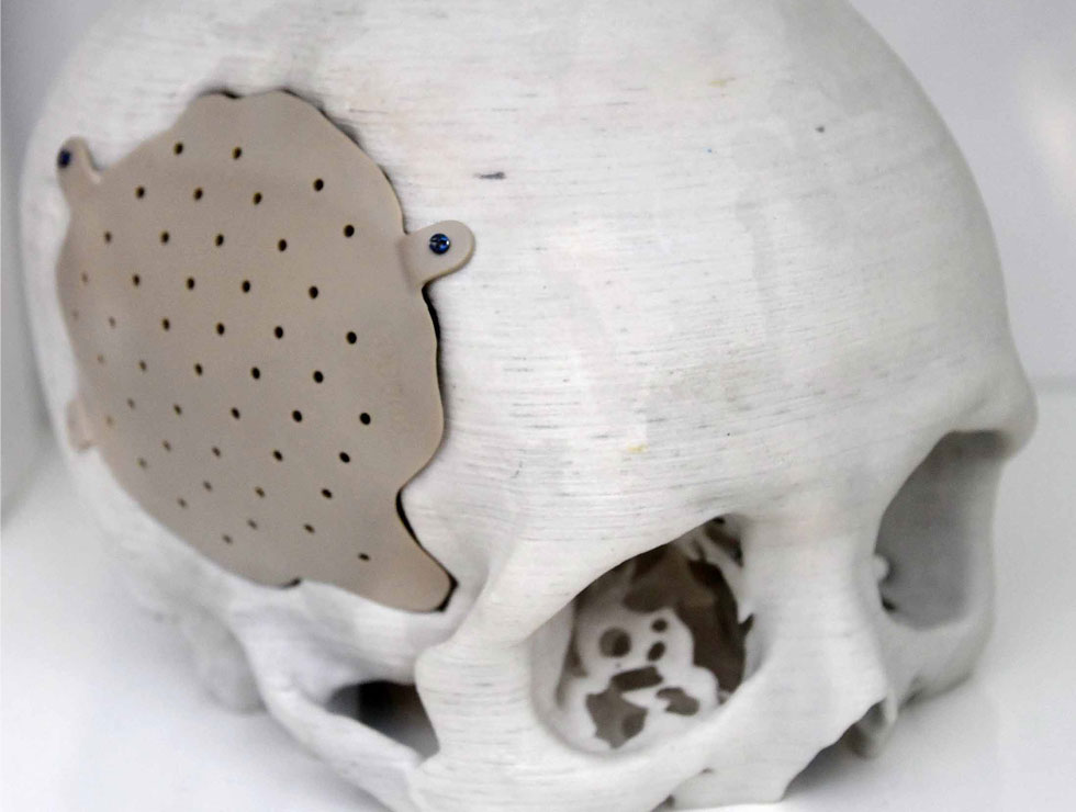 �@������ɫ�ĸ�ˎ��������Ŀ��������3D��ӡ���XĤ��